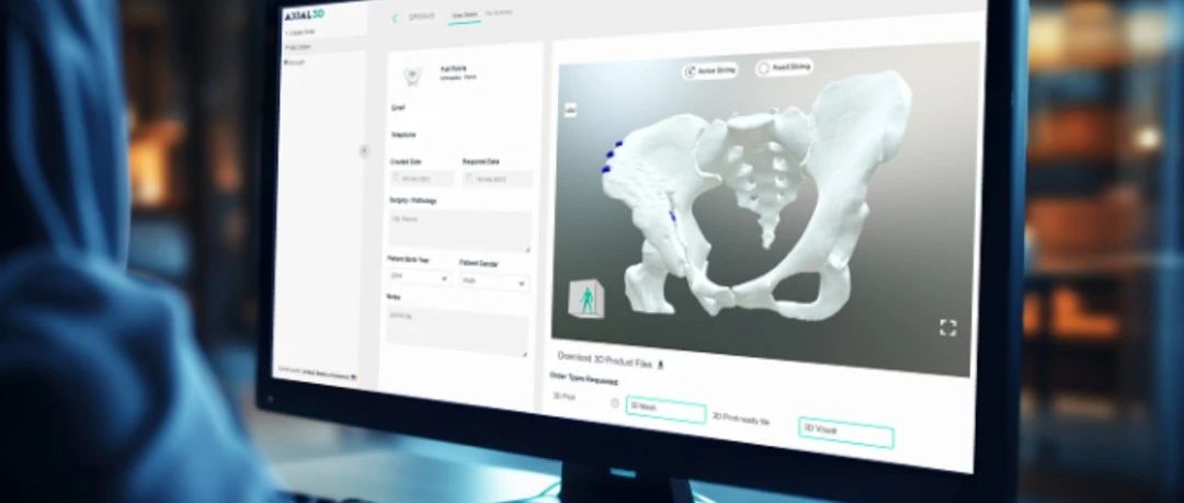 3D打印新闻简报：eSUN易生、英诺激光公布今年前三季度营收；威拉里高端制粉装备正式交付巴基斯坦等